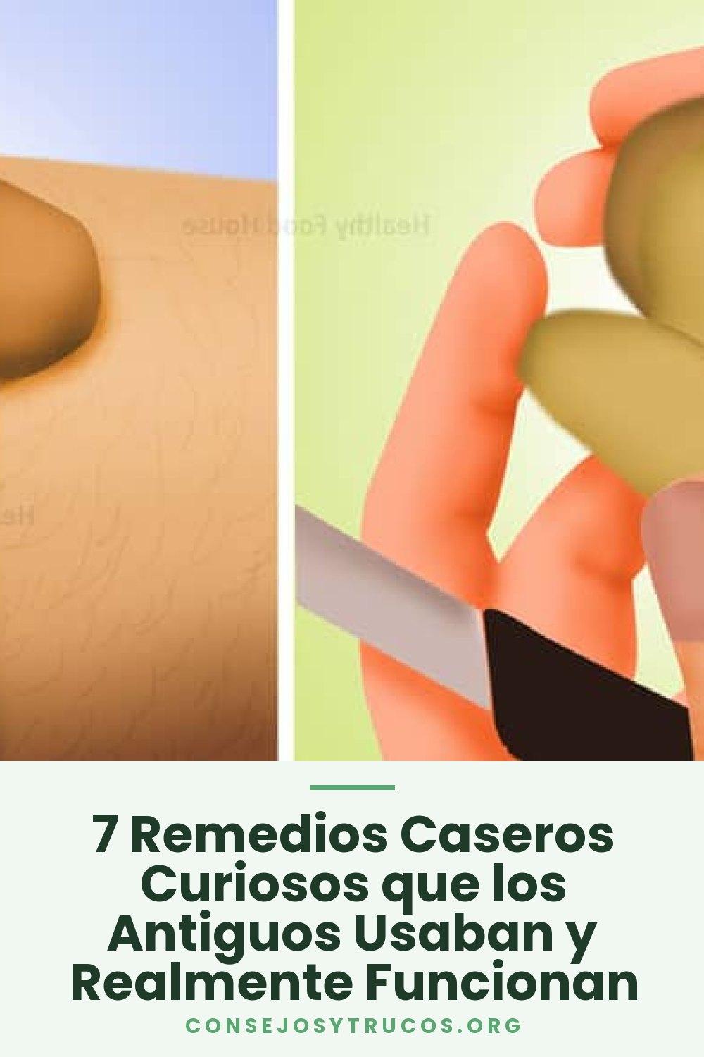 7 Remedios Caseros Curiosos que los Antiguos Usaban y Realmente Funcionan