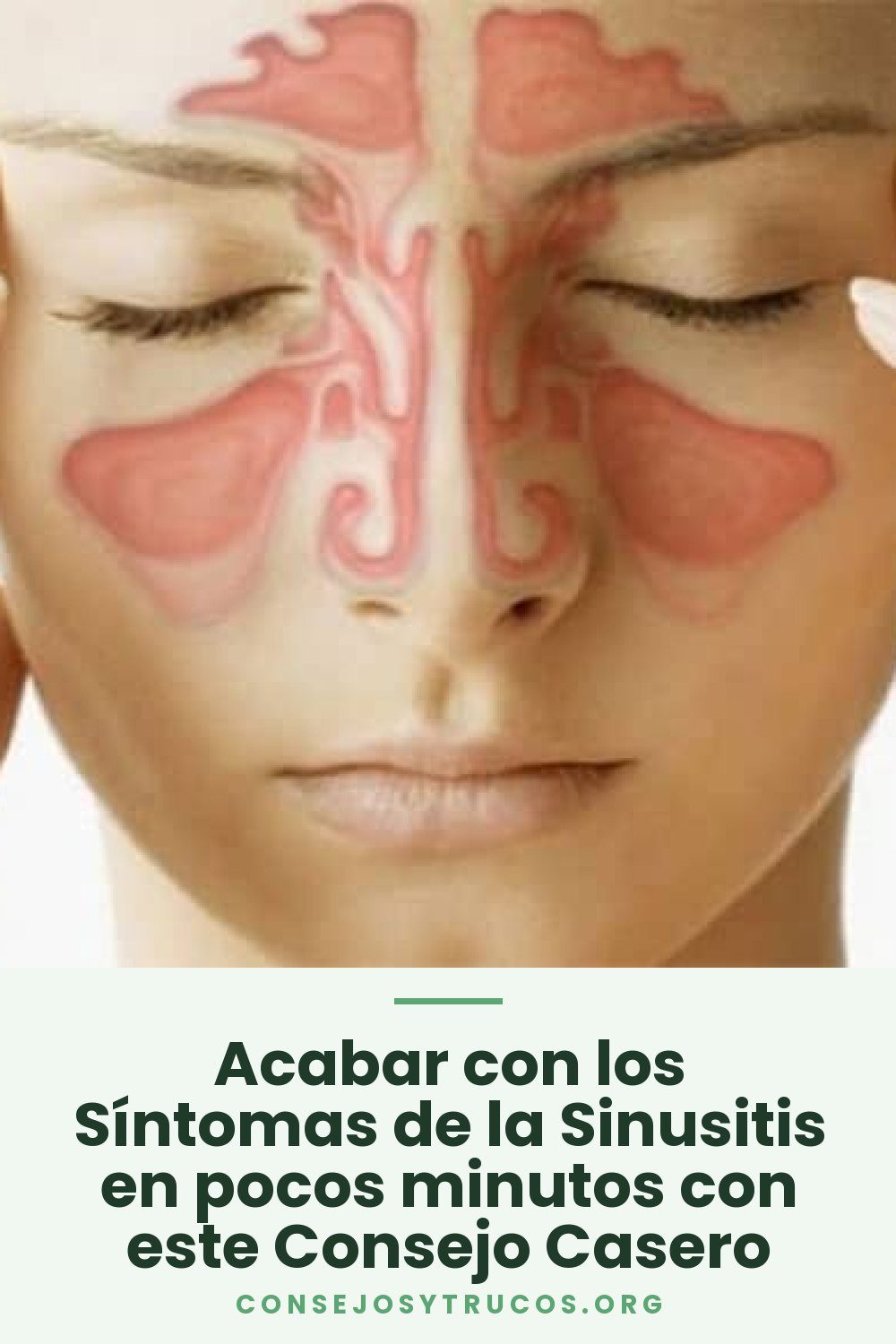 Acabar con los Síntomas de la Sinusitis en pocos minutos con este Consejo Casero