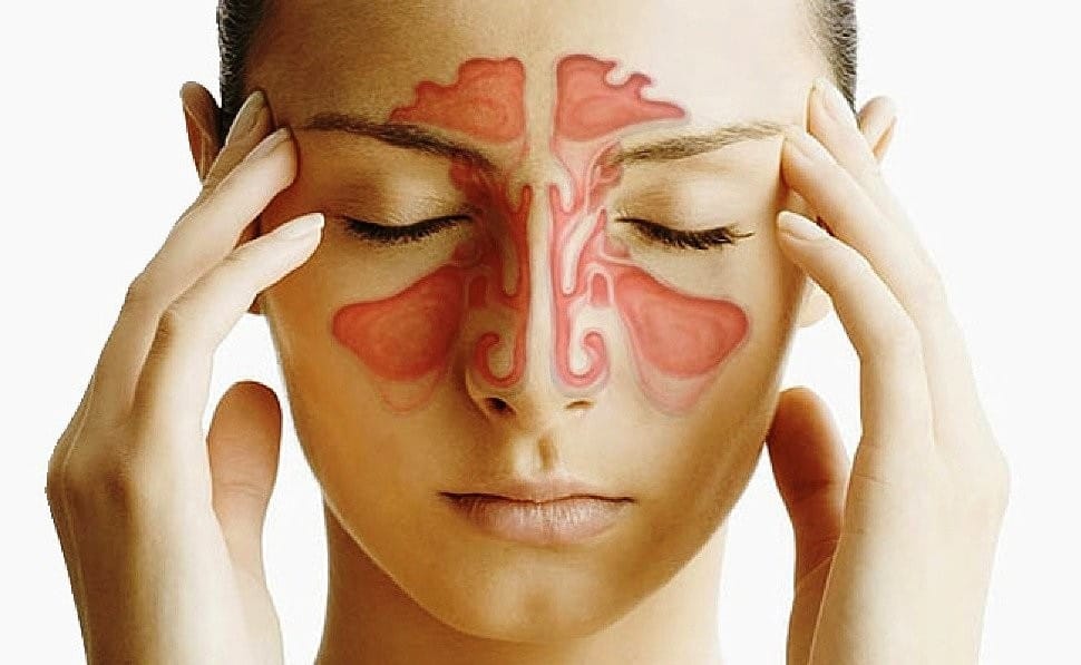 aliviar los sintomas de la sinusitis naturalmente3