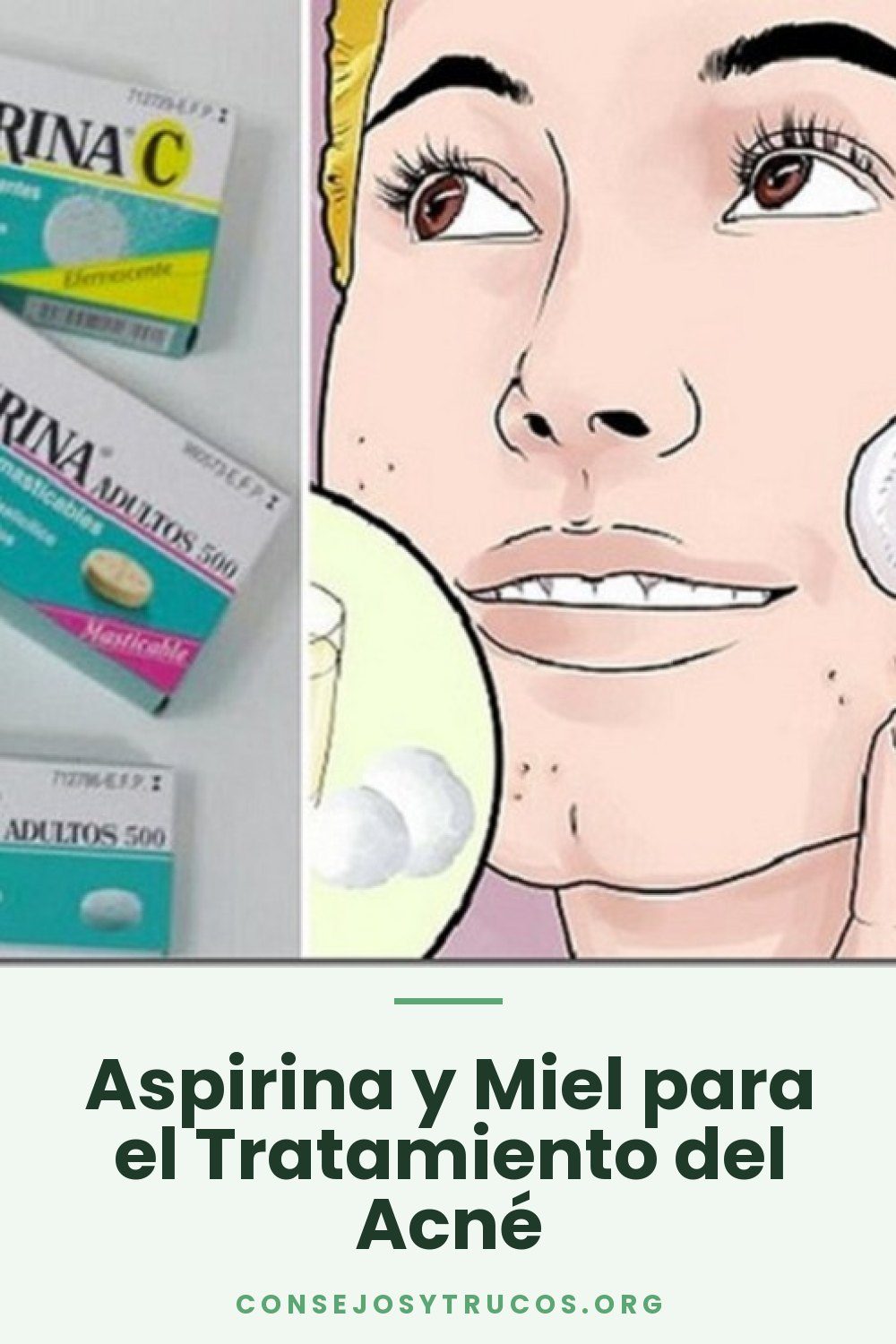 Aspirina y Miel para el Tratamiento del Acné