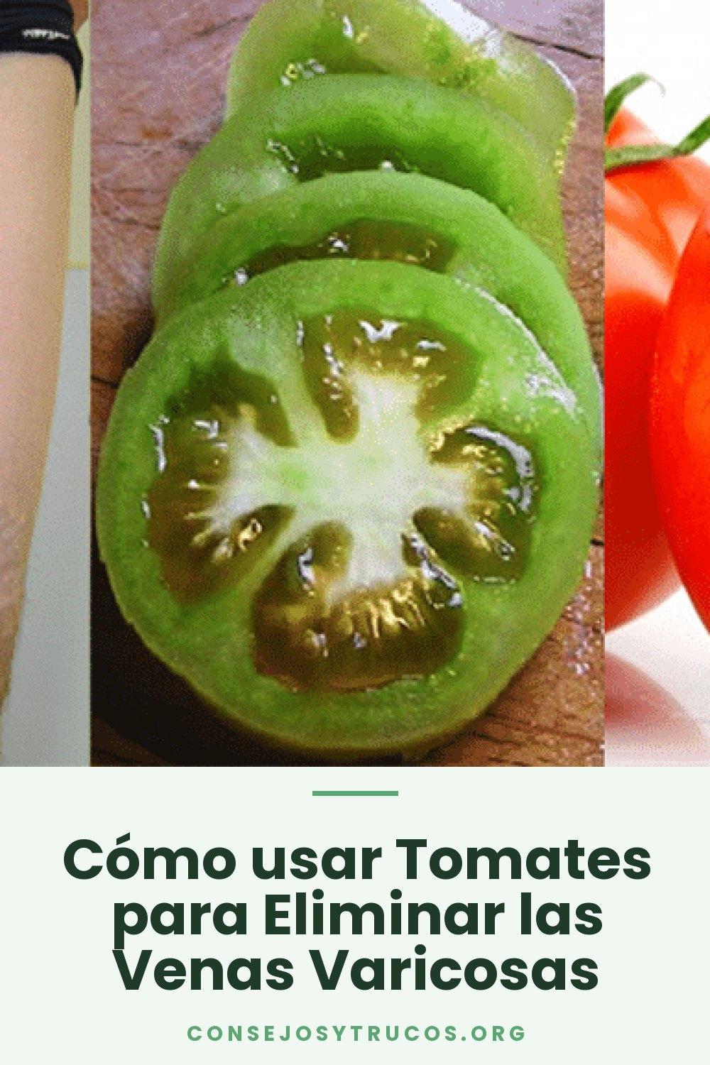 Cómo usar Tomates para Eliminar las Venas Varicosas