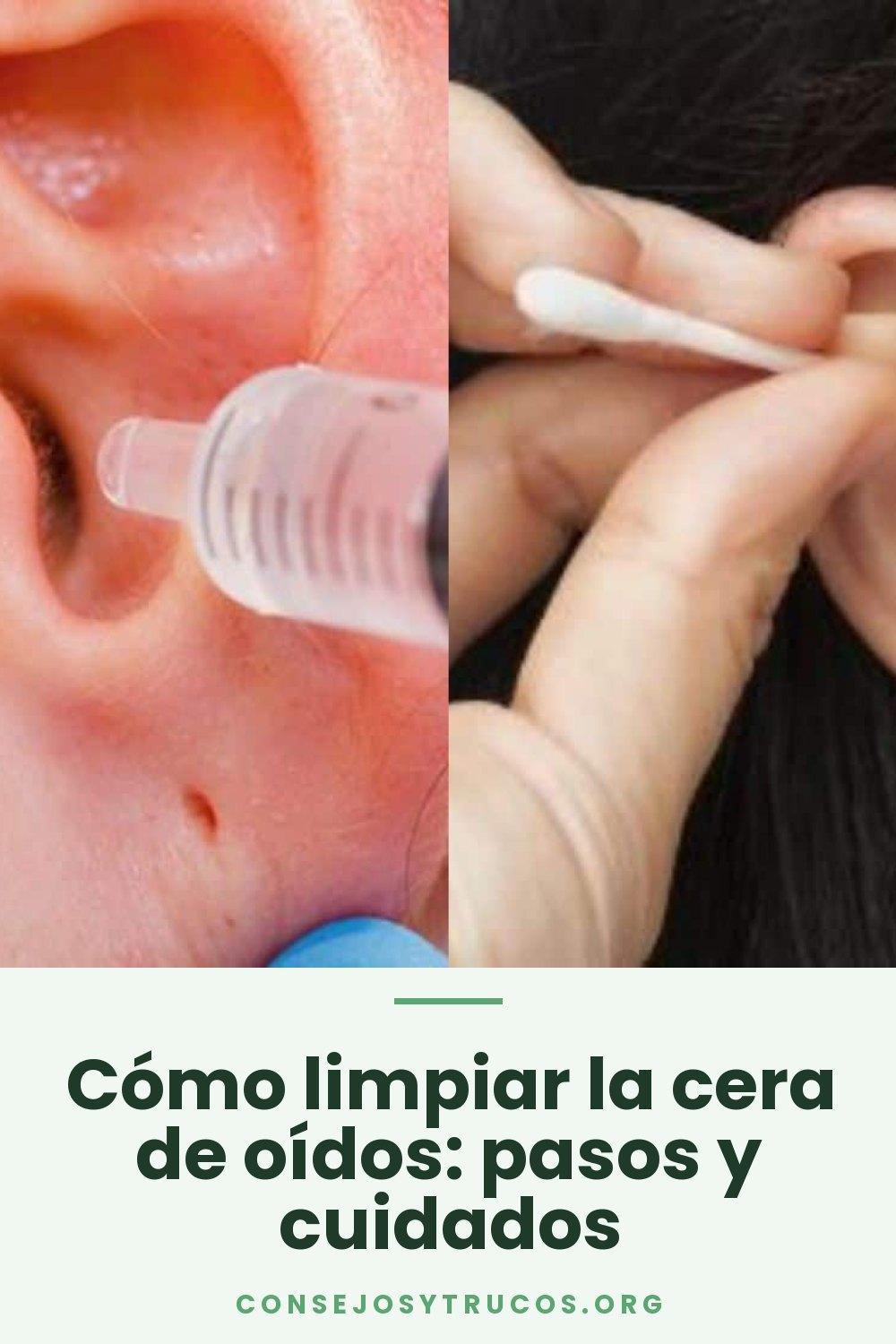 Cómo limpiar la cera de oídos: pasos y cuidados