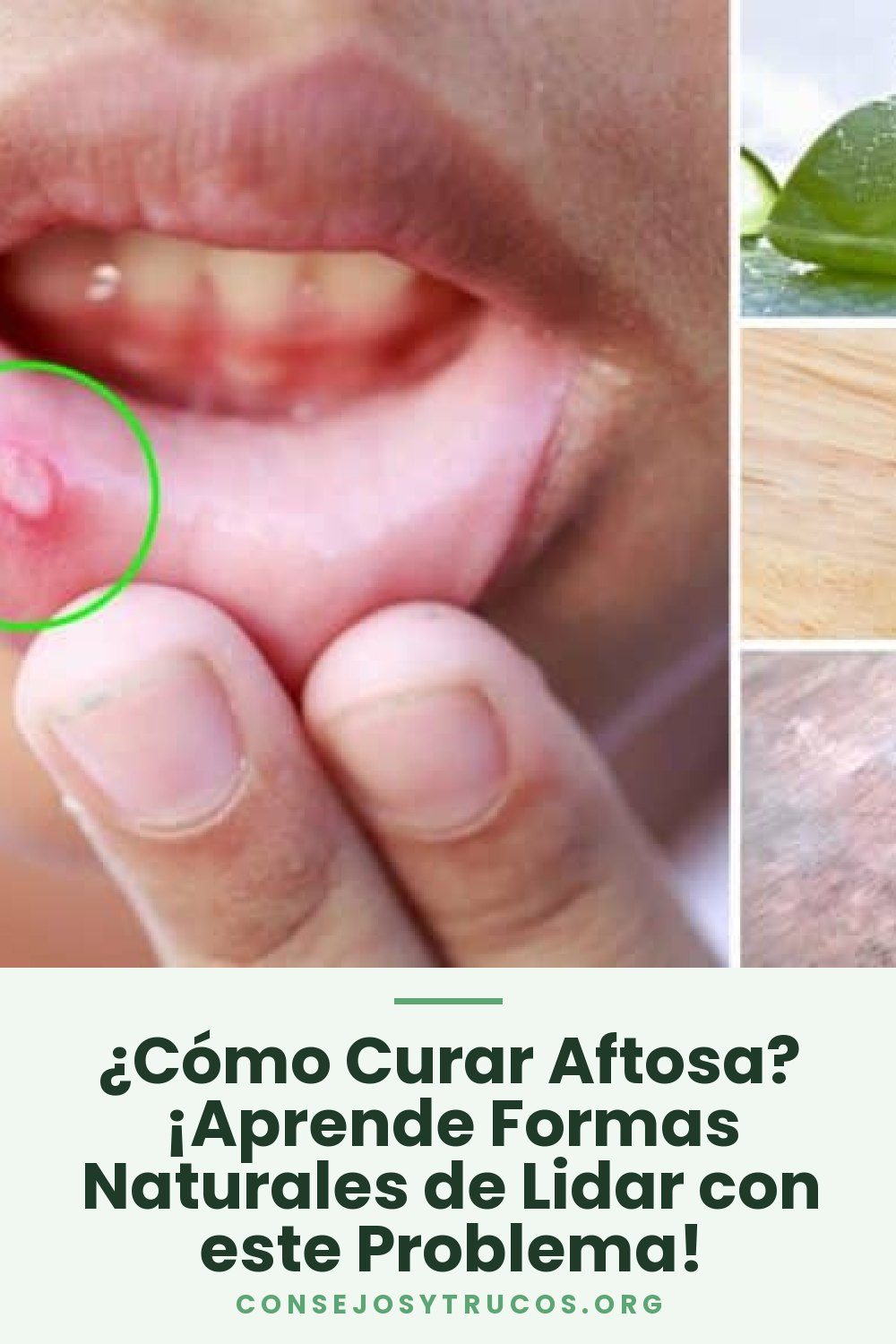 ¿Cómo Curar Aftosa? ¡Aprende Formas Naturales de Lidar con este Problema!