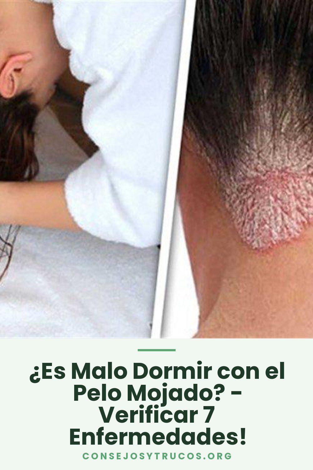 ¿Es Malo Dormir con el Pelo Mojado? - Verificar 7 Enfermedades!