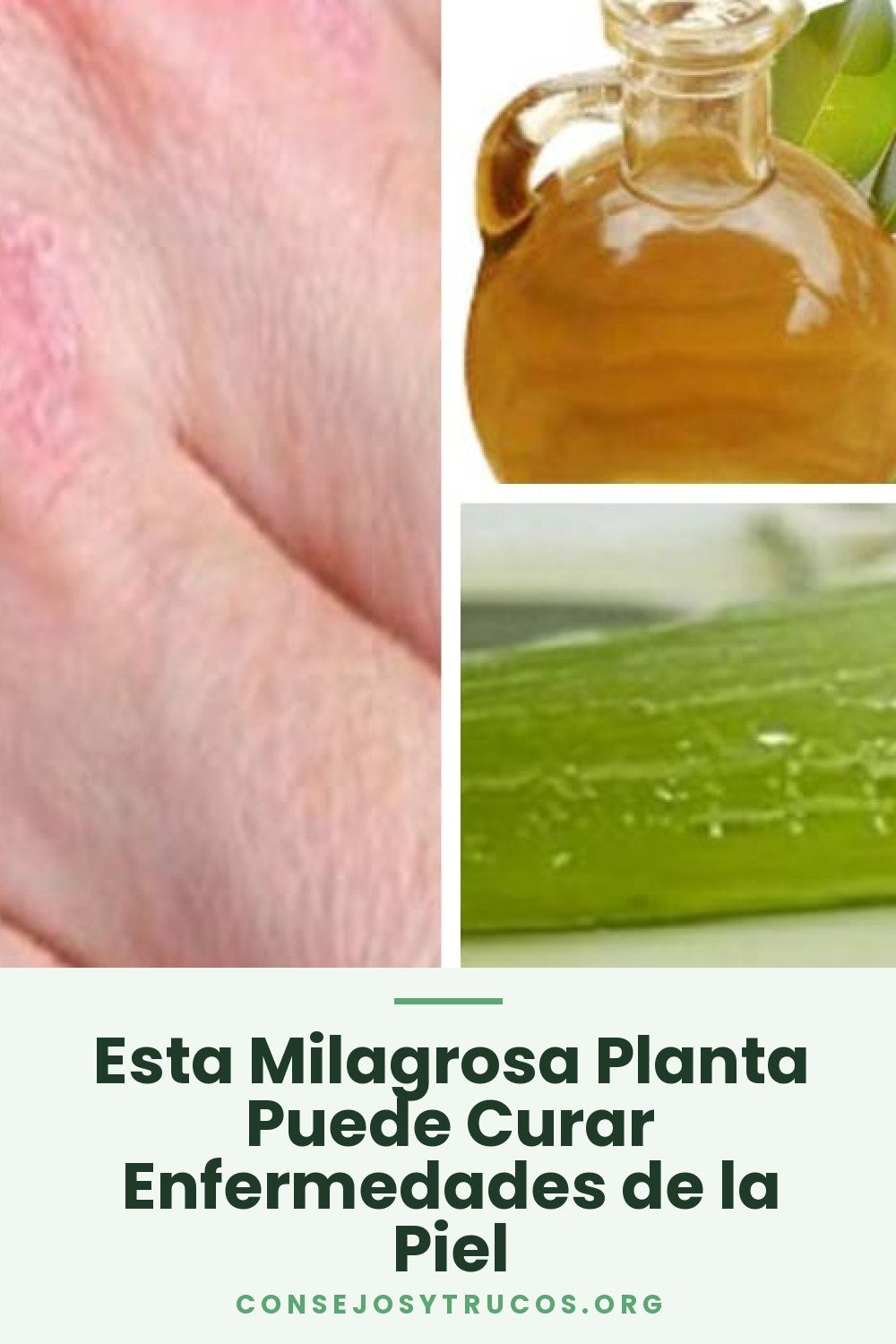 Esta Milagrosa Planta Puede Curar Enfermedades de la Piel