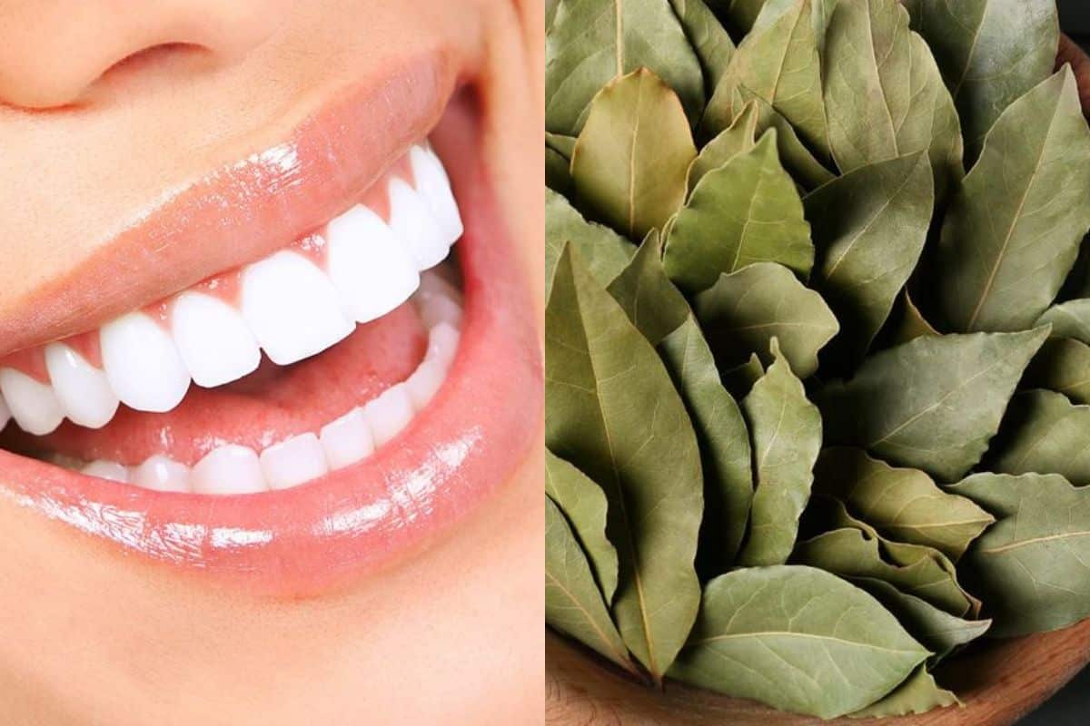 hojas de laurel para blanquear los dientes