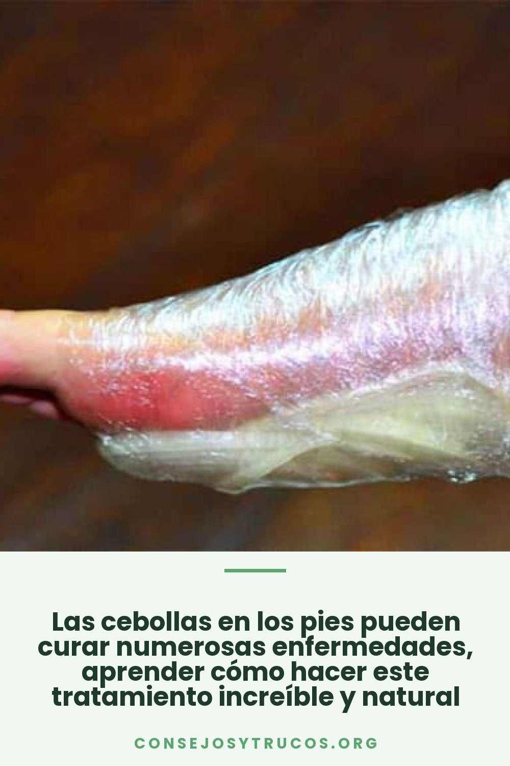 Las cebollas en los pies pueden curar numerosas enfermedades, aprender cómo hacer este tratamiento increíble y natural
