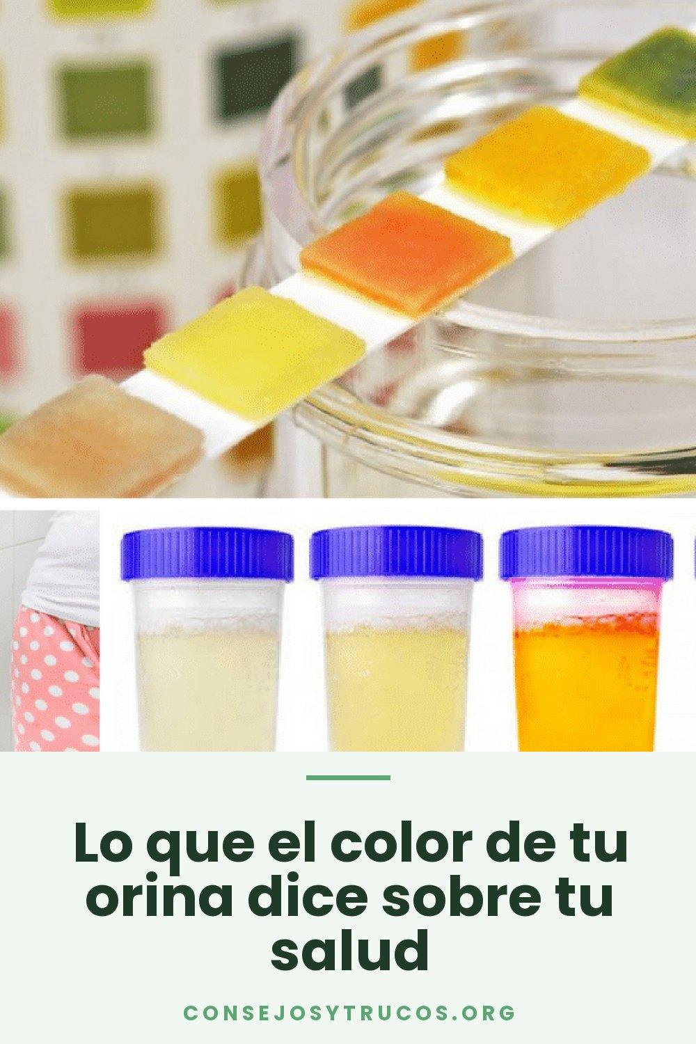 Lo que el color de tu orina dice sobre tu salud