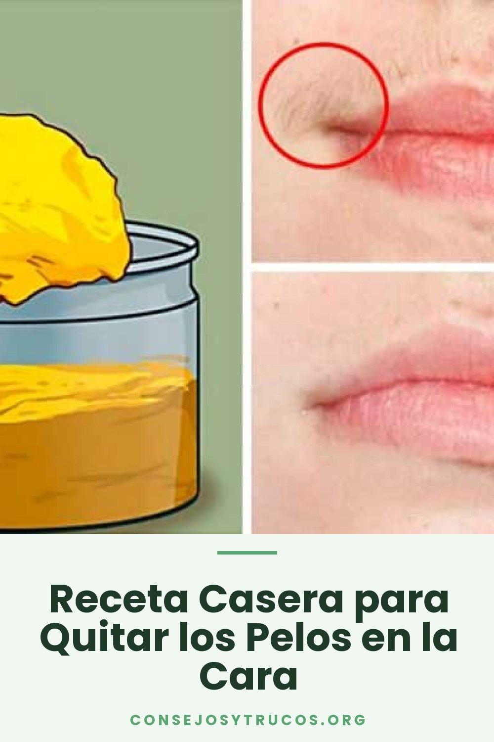 Receta Casera para Quitar los Pelos en la Cara