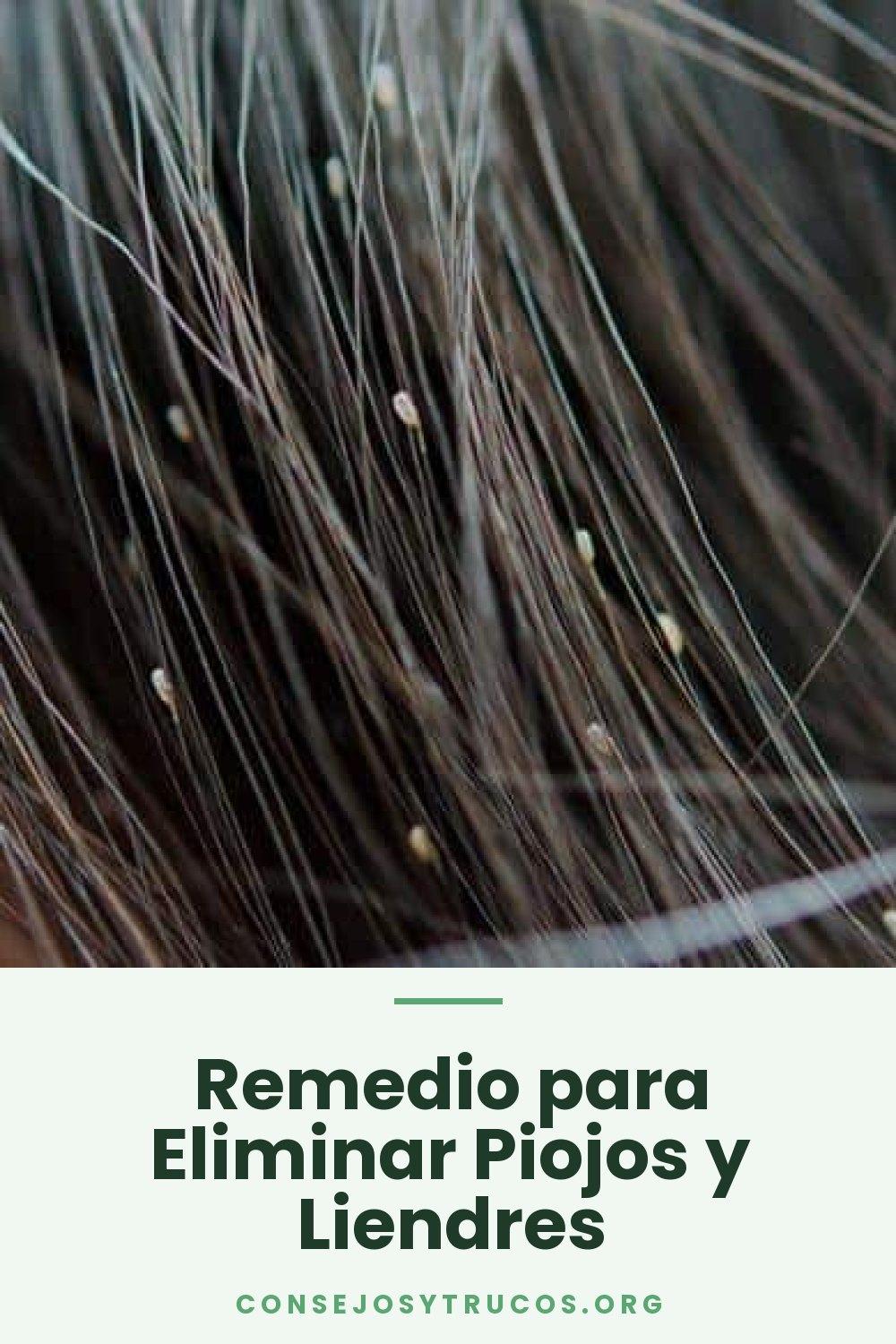 Remedio para Eliminar Piojos y Liendres