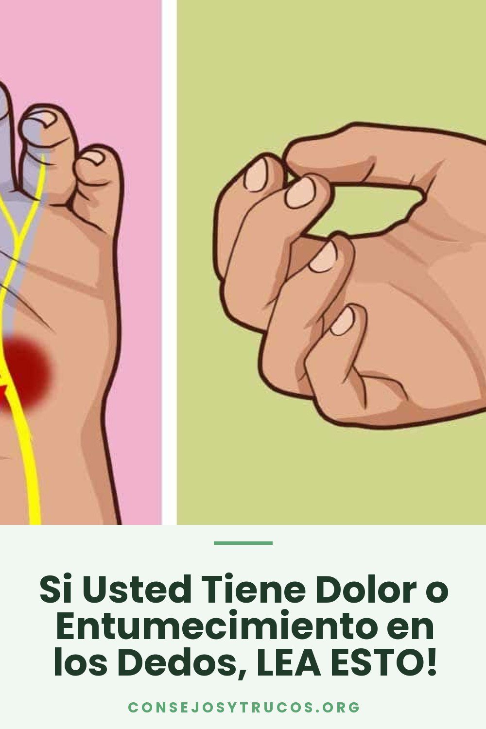 Si Usted Tiene Dolor o Entumecimiento en los Dedos, LEA ESTO!