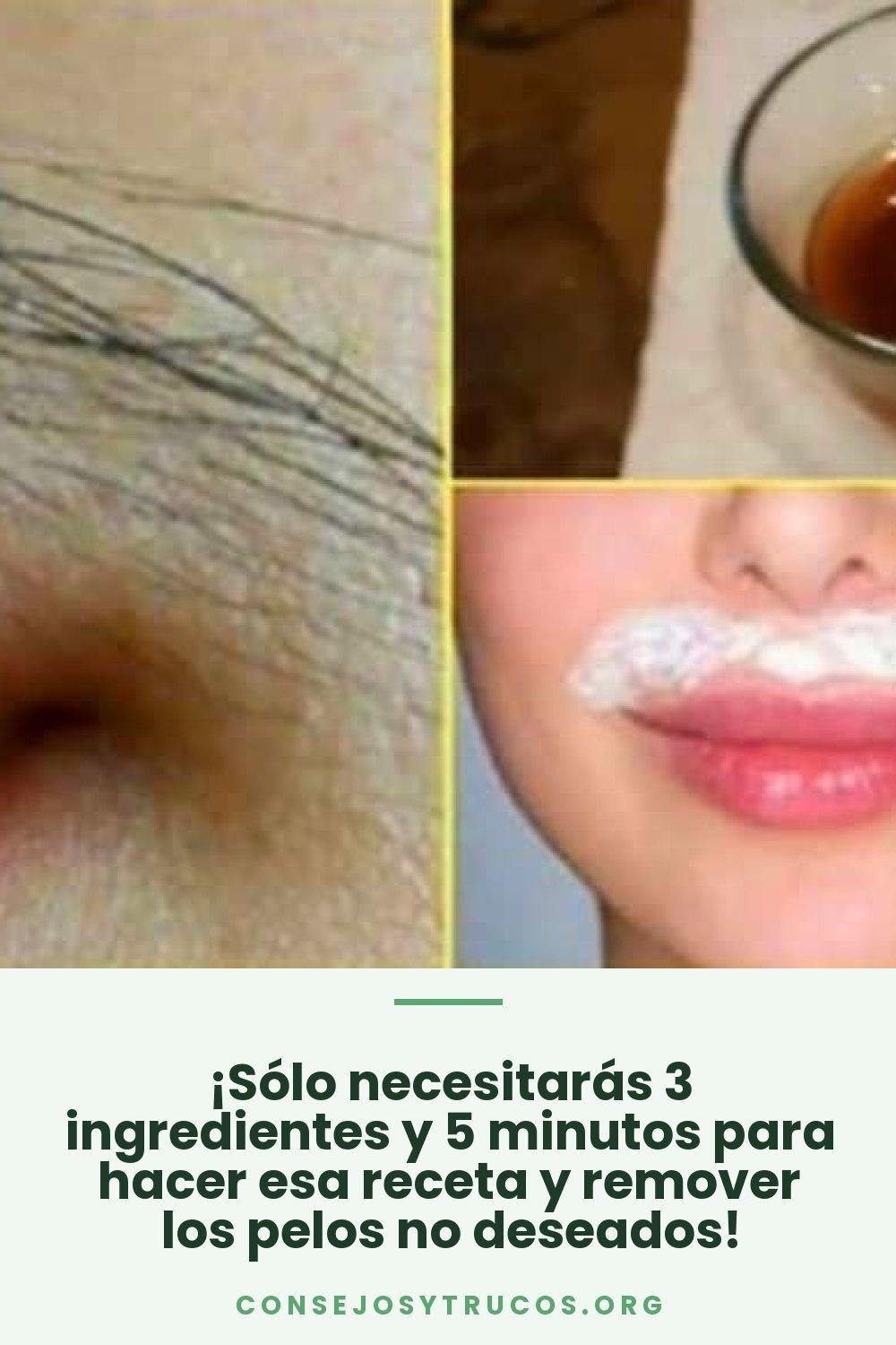 ¡Sólo necesitarás 3 ingredientes y 5 minutos para hacer esa receta y remover los pelos no deseados!