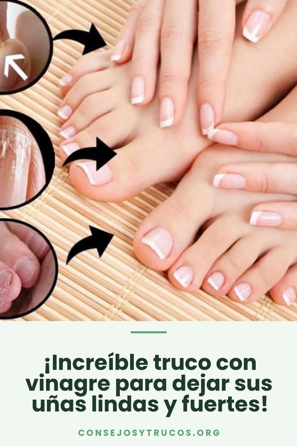 ¡Increíble truco con vinagre para dejar sus uñas lindas y fuertes!